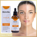 Serum vitamina C Biovella